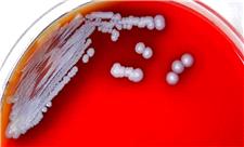 باکتری یک بیماری نادر و خطرناک از آب و خاک جنوب آمریکا سر درآورد