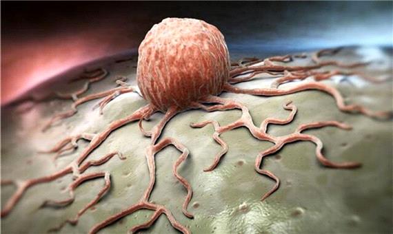 گرما رشد سلول های سرطانی را دشوار می‌کند