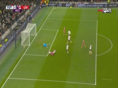 مصدومیت شدید ایساک که منجر به تعویض شد