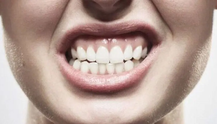 دندان‌قروچه؛ پیام پنهان خشم و استرس شما