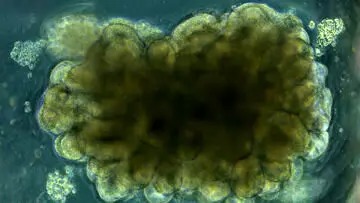 دانشمندان «مینی‌مغز» ساختند و به آن حل مسئله یاد دادند