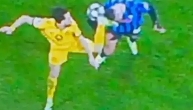 زخم دردناک صورت ستاره آتالانتا؛ فن کاراته بود؟