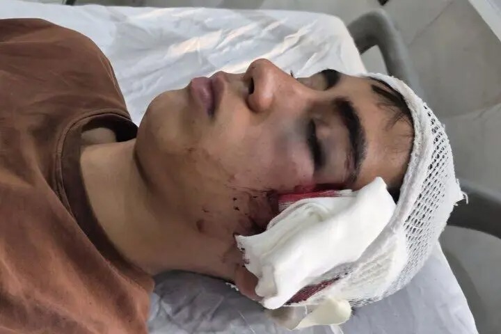 ضرب‌وشتم دانش‌آموز با دسته صندلی/ روایت پدر از خشونت علیه فرزندش در دبیرستان دهبکری بم / آموزش‌وپرورش وعده پیگیری داد